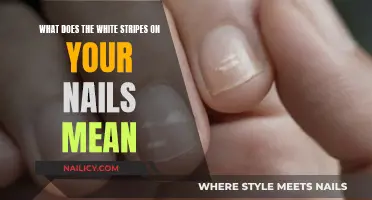 Unraveling the Mystery: What Do White Stripes on Nails Indicate?