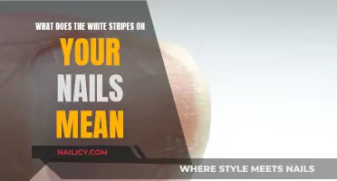 The Mystery of White Stripes on Nails: What Do They Mean?
