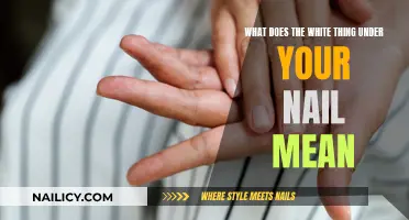 The Mystery of White Spots Under Your Nails