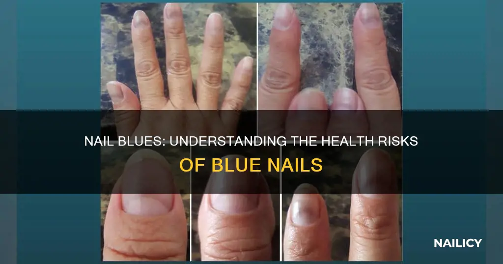 what does this mean when your nails are blue
