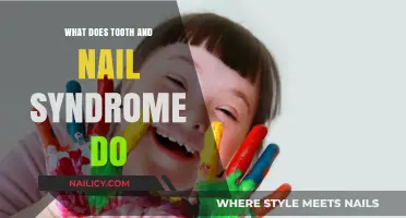 Understanding Tooth and Nail Syndrome: Symptoms, Causes, and Treatment Options
