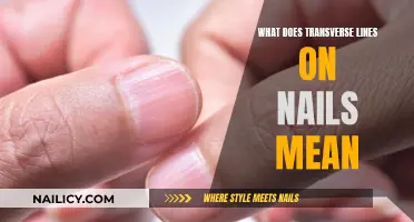 Unraveling the Mystery: Transverse Lines on Your Nails