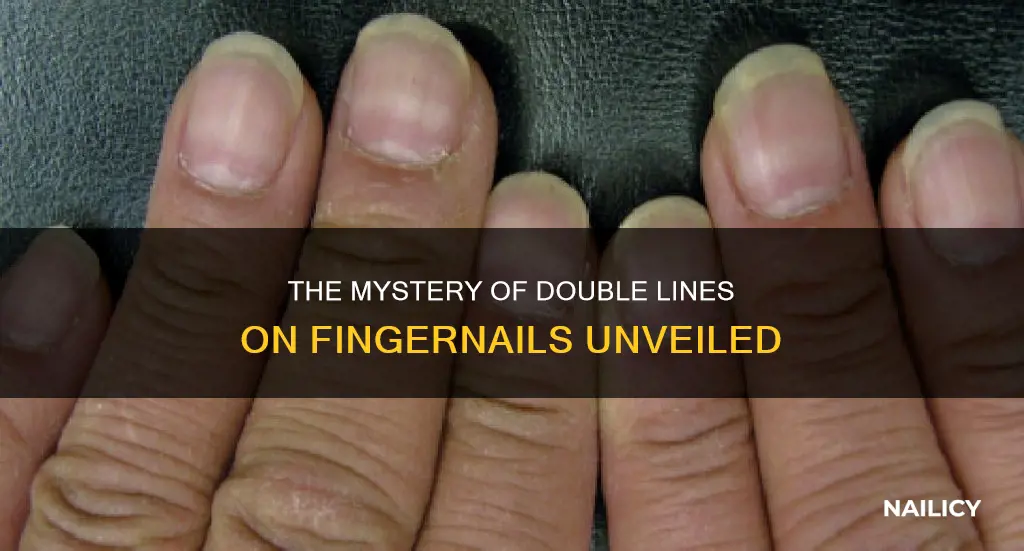 what does two lines on a finger nail means