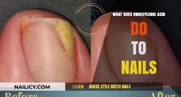 Undecylenic Acid Benefits: How It Treats and Strengthens Nails
