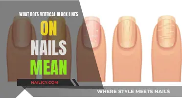 Unraveling the Mystery: Vertical Black Lines on Nails