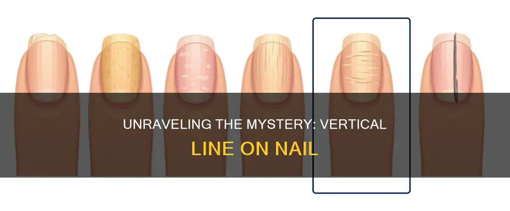 what does vertical line on nail mean