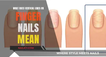 Unraveling the Mystery: Vertical Lines on Your Nails