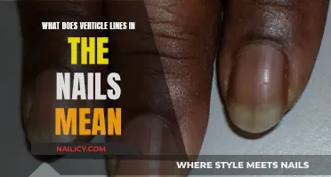 Unraveling the Mystery: Vertical Lines on Nails