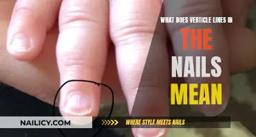 Vertical Lines on Nails: What Do They Indicate?
