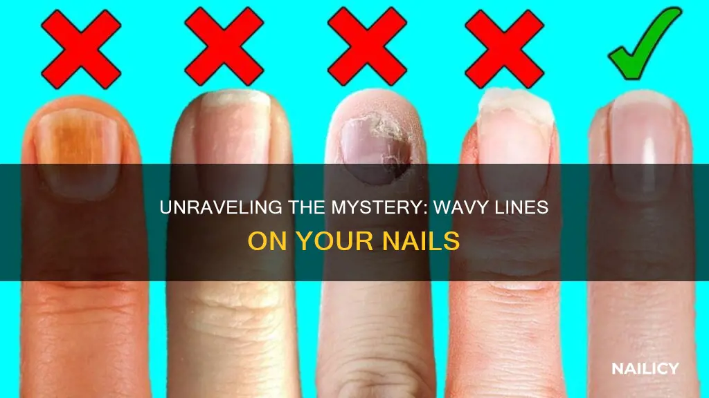 what does wavy lines on your finger nails indicate