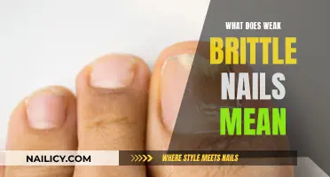 Brittle Nails: What Do They Mean for Your Health?
