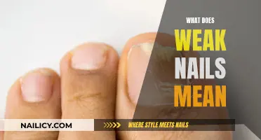 Weak Nails: What Does It Mean?