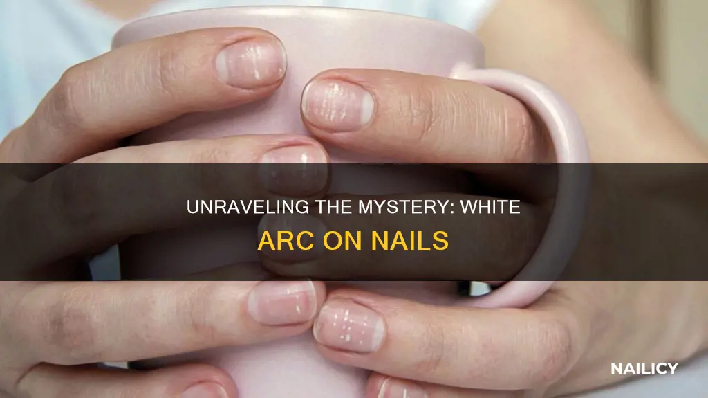 what does white arc on nails mean