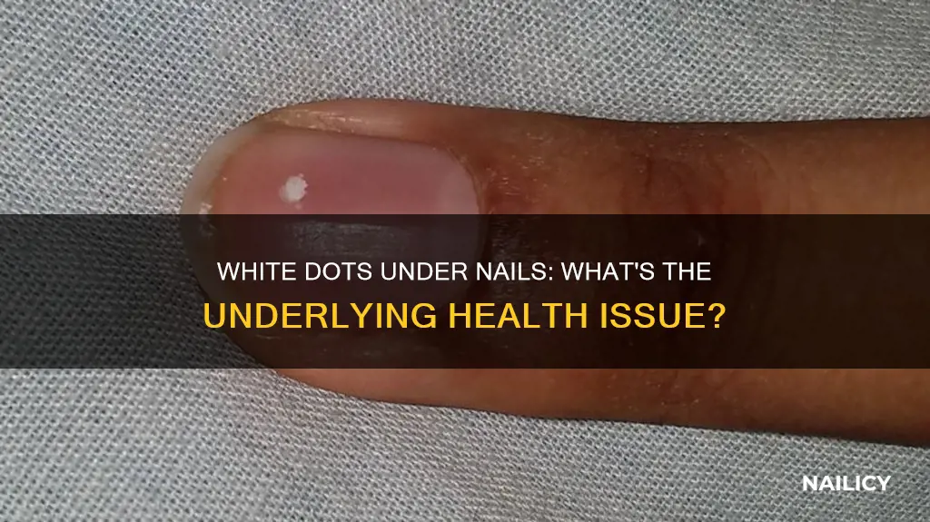what does white dots under your nails mean