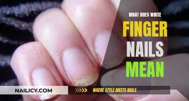 White Finger Nails: Understanding the Possible Causes and Treatments