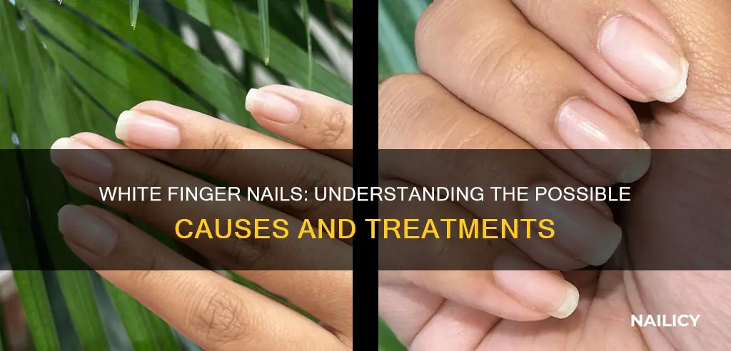 what does white finger nails mean