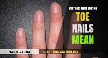 Unraveling the Mystery: White Lines on Your Toenails