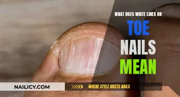 White Lines on Toenails: What Do They Mean?