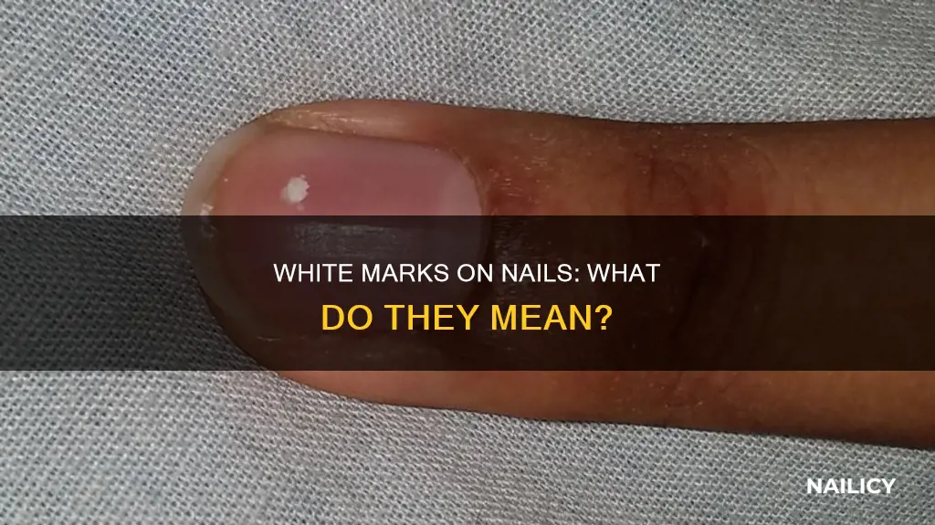 what does white mark on nail mean