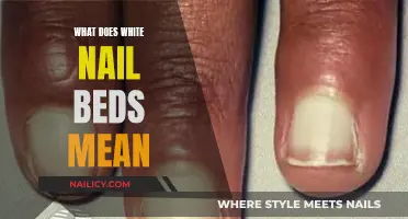 Uncover the Mystery: What Your White Nail Beds Might Mean