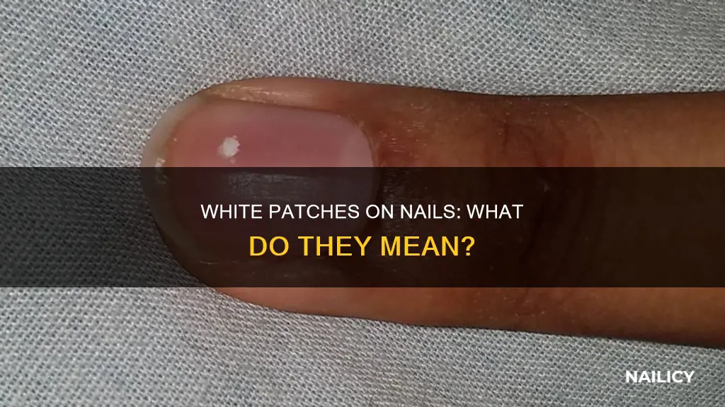 what does white patch on nail mean