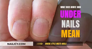 Uncover the Mystery: White Skin Under Nails