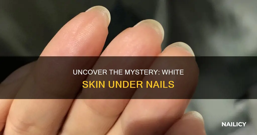 what does white skin under nails mean