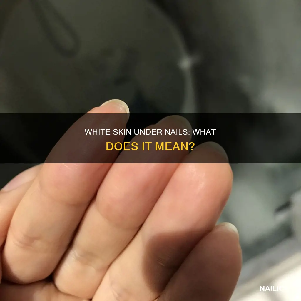 what does white skin under nails mean