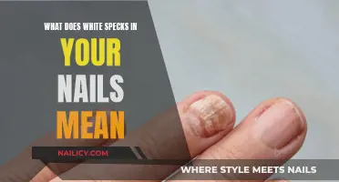 Unraveling the Mystery: White Specks in Your Nails