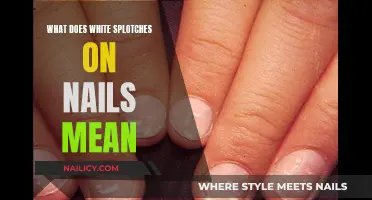 White Splotches on Nails: What Your Body Is Telling You