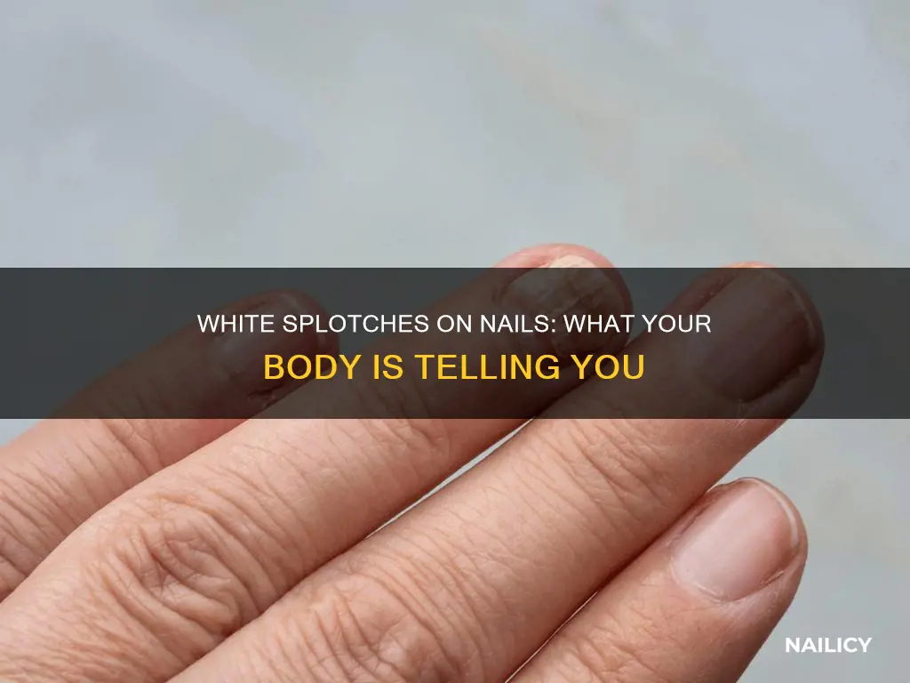 what does white splotches on nails mean