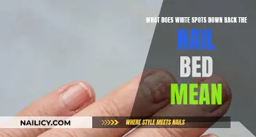 White Spots on Nails: What Do They Mean?