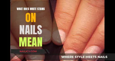 White Stains on Nails: What Do They Mean?