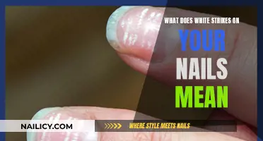 White Strikes on Nails: What's the Deal?