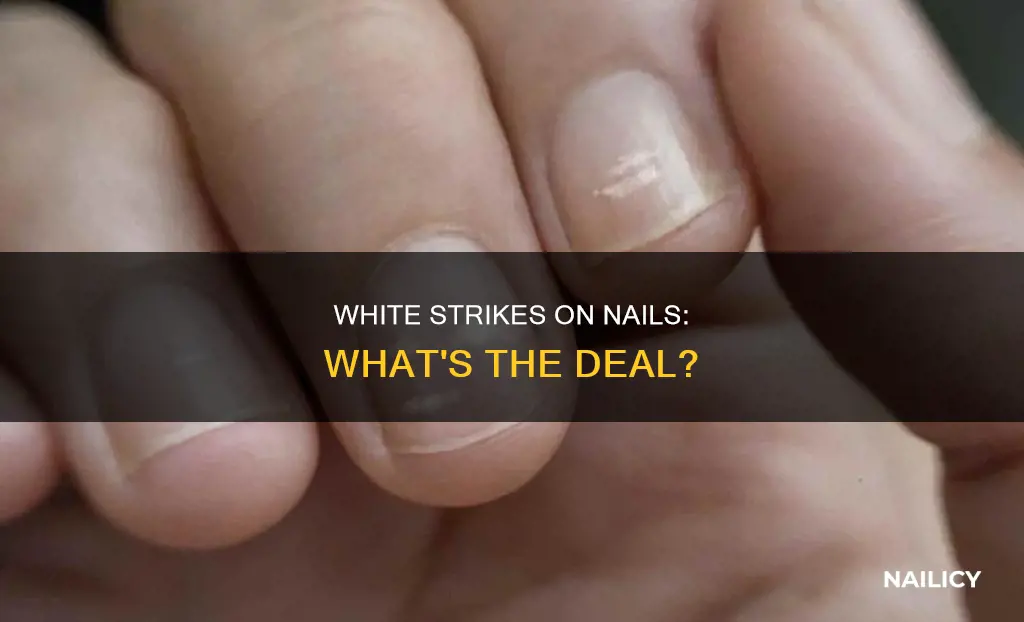 what does white strikes on your nails mean