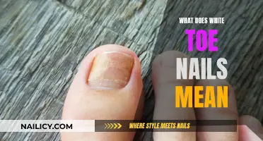 Unraveling the Mystery: What Your White Toe Nails Could Mean