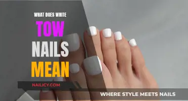 White Toenails: What Do They Mean for Your Health?