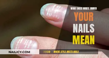 Uncover the Mystery: White Beneath Your Nails