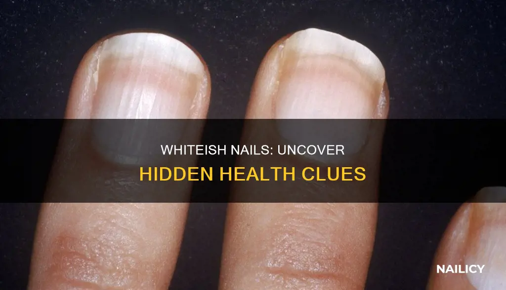 what does whiteish finger nails mean health wise