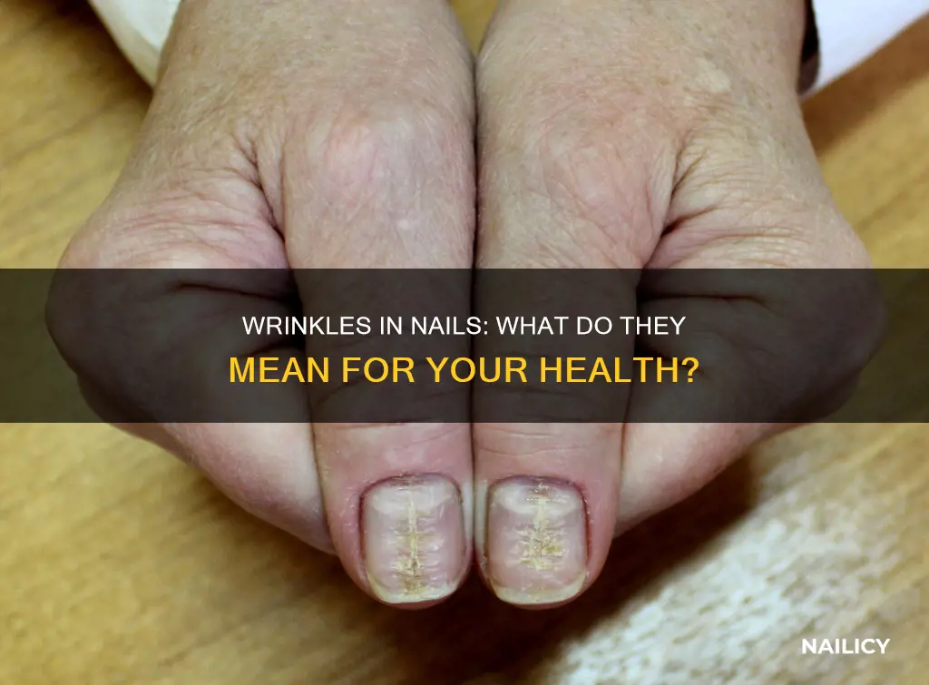 what does wrinkles in your nails mean