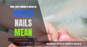 Understanding Nail Wrinkles: What Do They Mean?