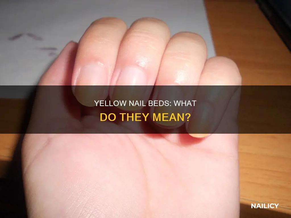 what does yellow nail beds mean
