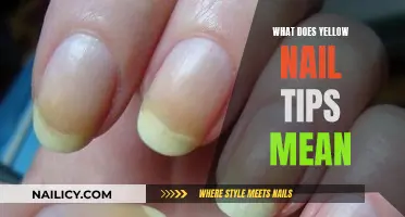 Yellow Nail Tips: What Do They Mean?