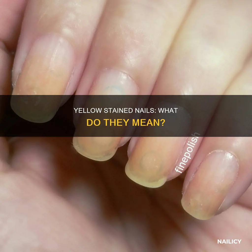what does yellow stained nails mean