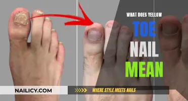 Unraveling the Mystery: What Does a Yellow Toe Nail Indicate?