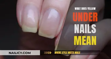 Unraveling the Mystery: What Does Yellow Under Nails Indicate?