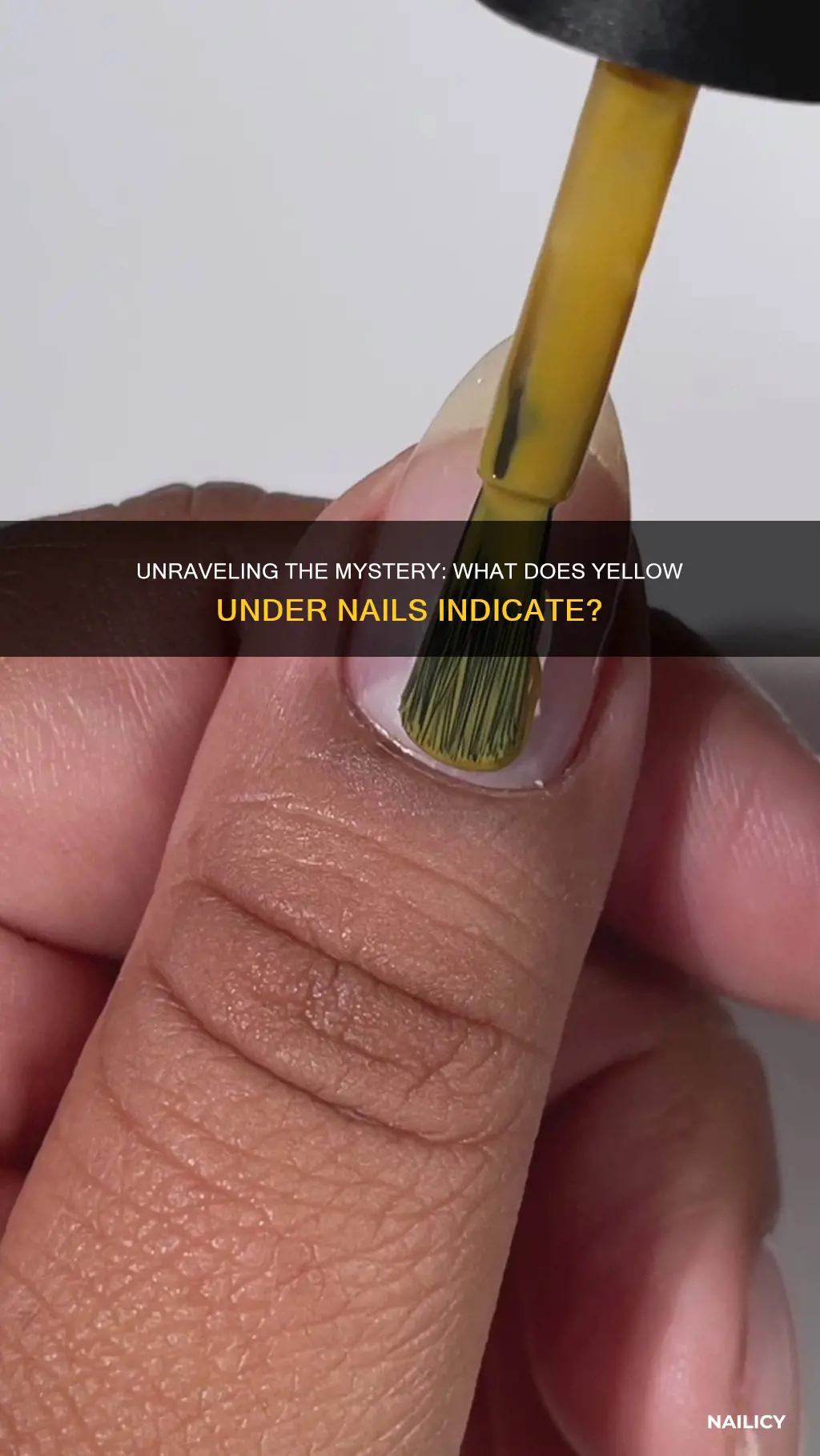 what does yellow under nails mean