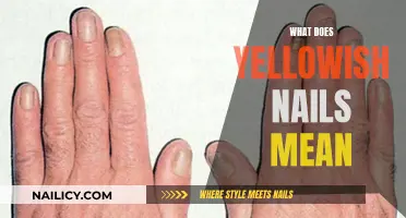 Unraveling the Mystery: Yellowish Nails and Their Possible Meanings