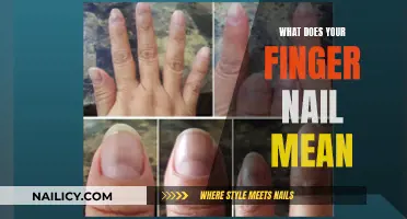 The Meaning of Fingernails: A Health Indicator