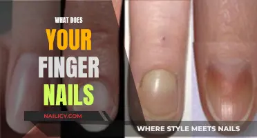 Uncover the Secrets: What Your Fingernails Reveal About Your Health